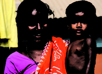 India